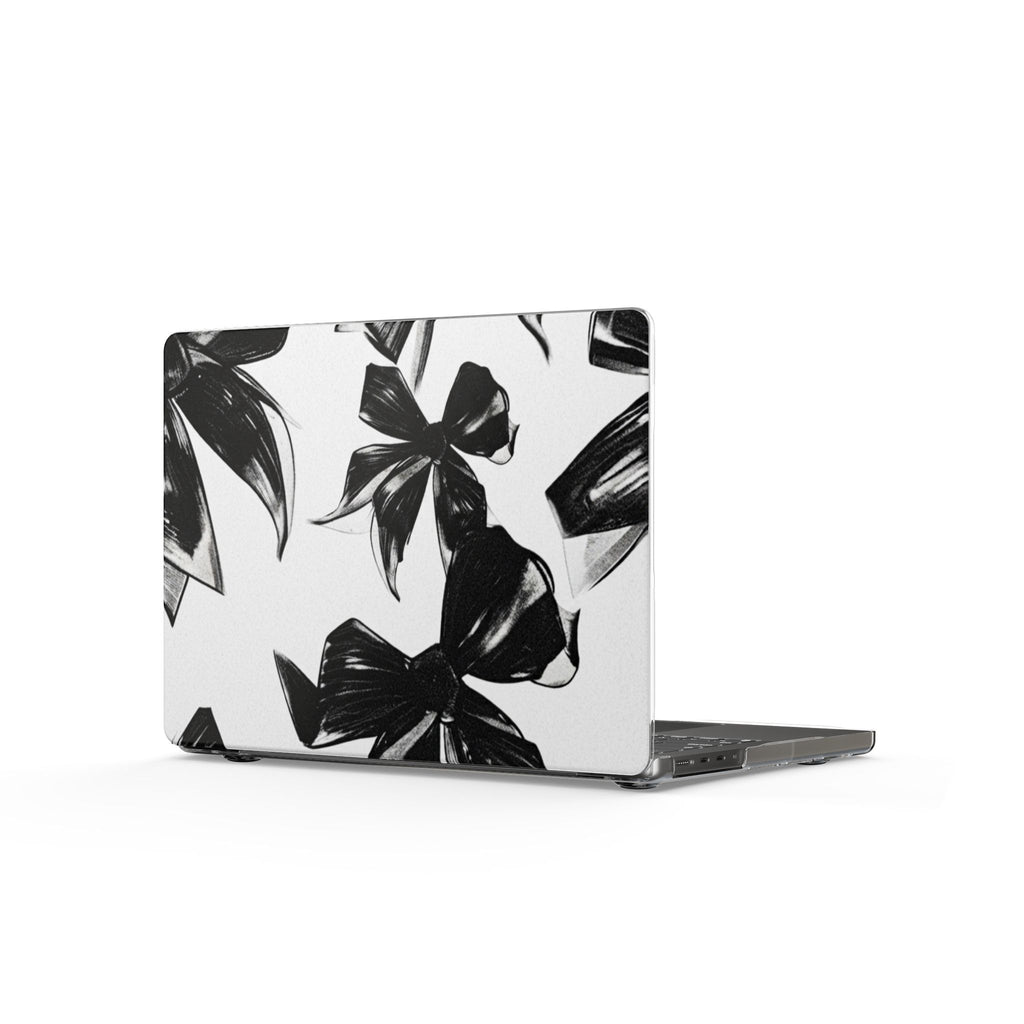 Black Botanical Clear MacBook Case – Minimal Floral Laptop Cover