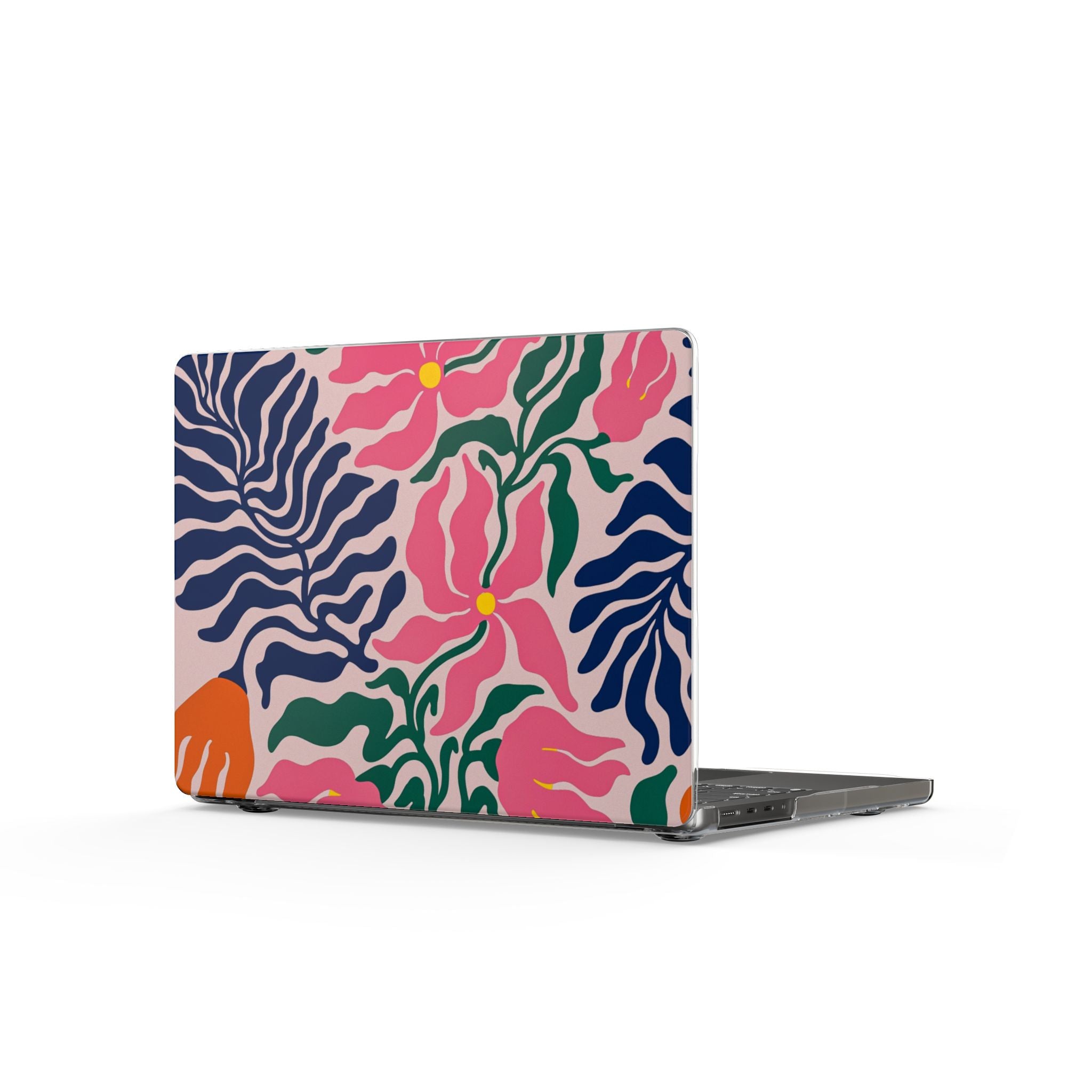 Floral Tropics MacBook Case — Bold Pink & Navy Leaf Pattern