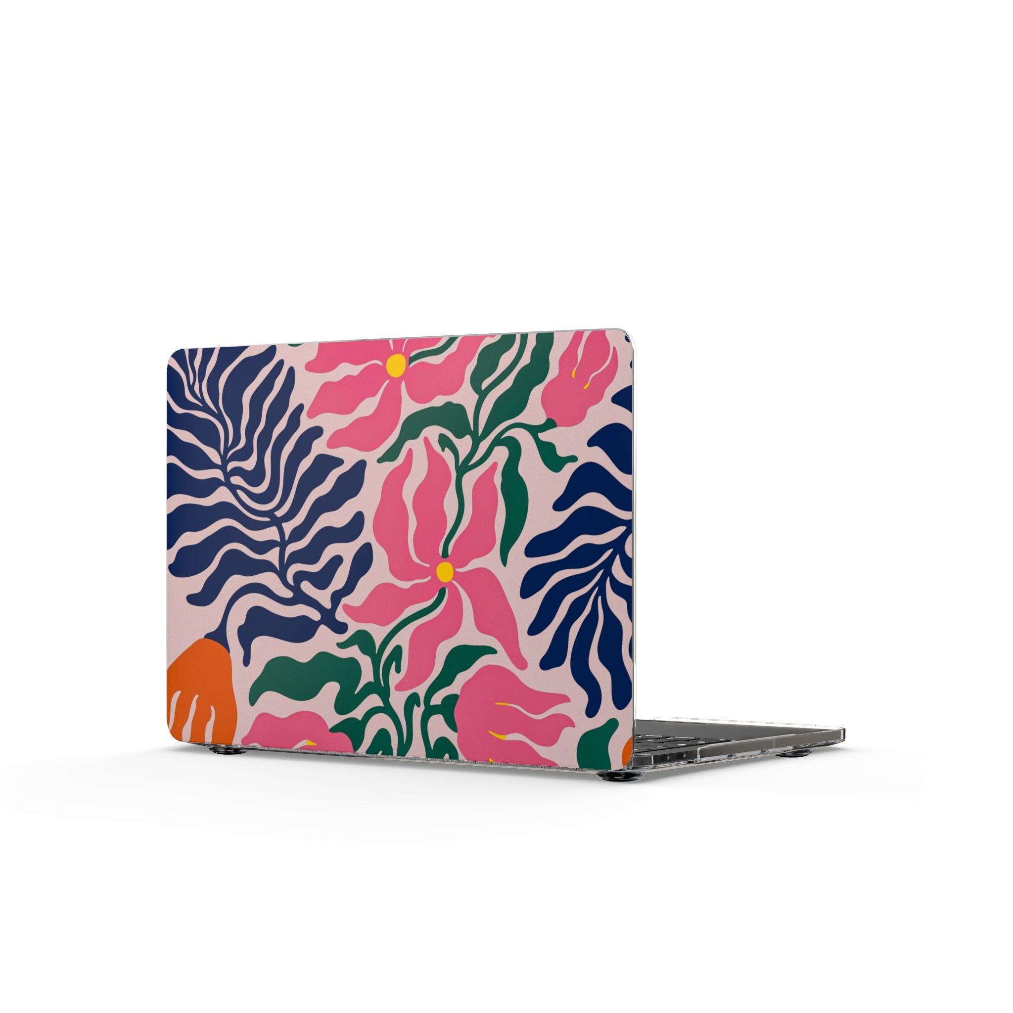 Floral Tropics MacBook Case — Bold Pink & Navy Leaf Pattern